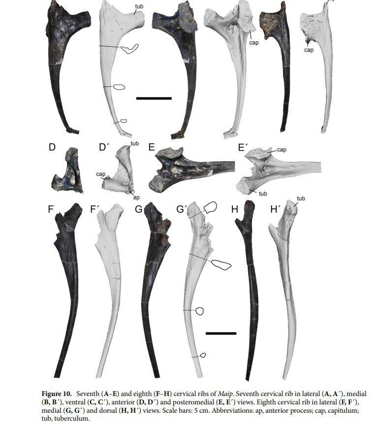 MAIP huesos costilas