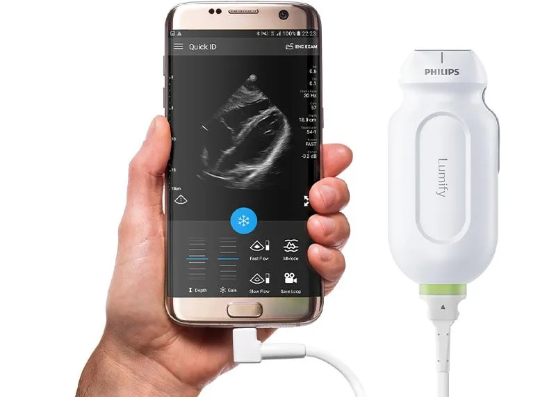 Ecografo portatil