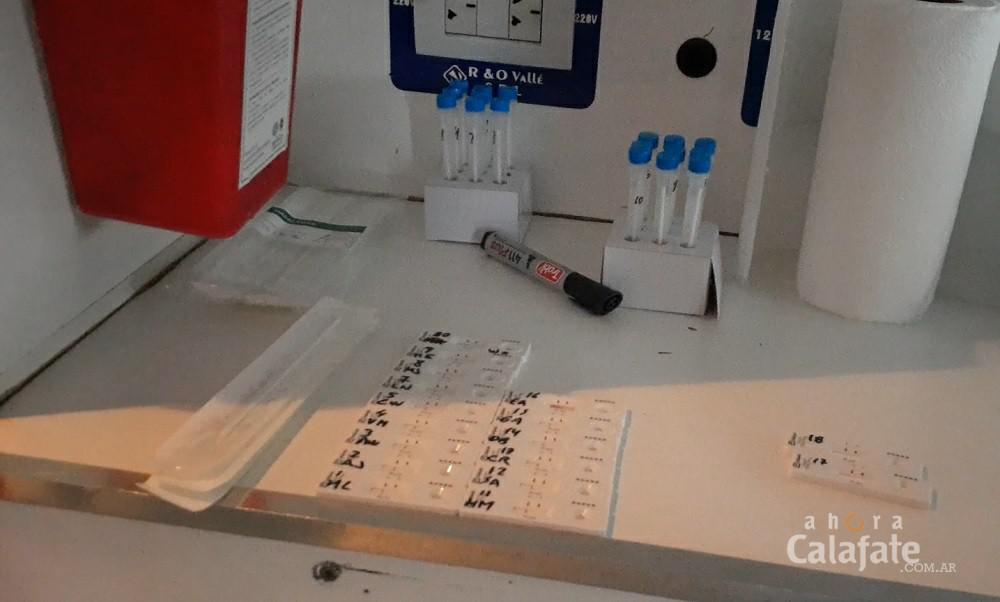 test rapidos [AUDIO FMD]