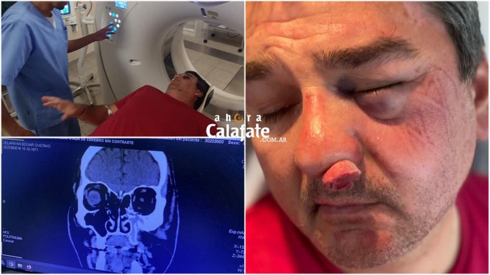 FormatFactoryChofer Golpeado [AUDIO FMD]